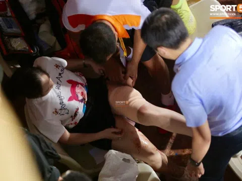 Bác sĩ Bệnh viện Xanh Pôn thông tin vụ nữ CĐV bị pháo sáng bắn trúng