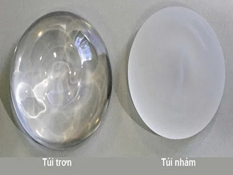 Đặt túi ngực bao nhiêu tiền? Hướng dẫn chọn túi ngực an toàn cho phái đẹp