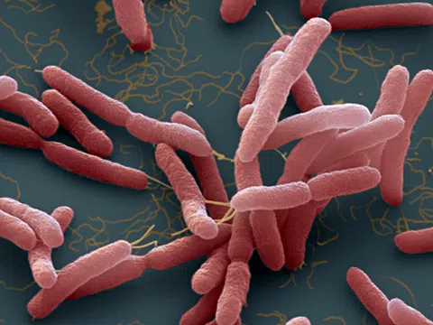 4 bệnh nhân BV Bạch Mai tử vong do whitmore, những dấu hiệu cần biết