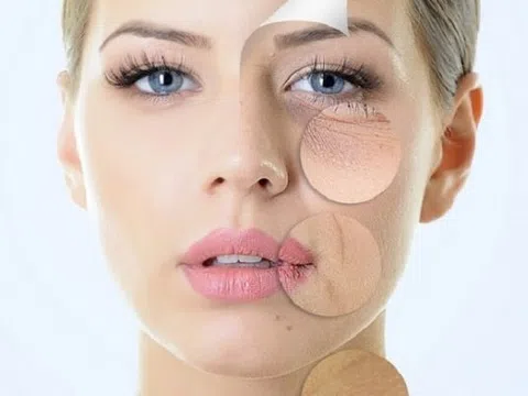 7 thực phẩm 'khắc tinh' của nếp nhăn