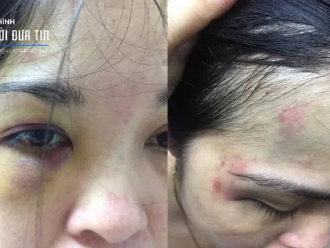 Vụ hành hung, ép 'quan hệ' ở Thanh Hoá: Có dấu hiệu bỏ lọt tội phạm?