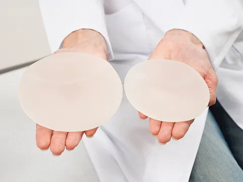 So sánh và đánh giá các phương pháp nâng ngực nội soi hiện nay