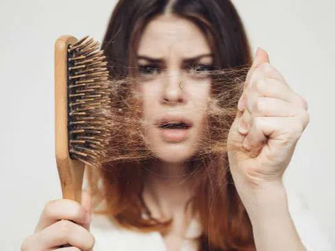 Những mẹo hiệu quả giúp tóc không còn rụng ngày giao mùa