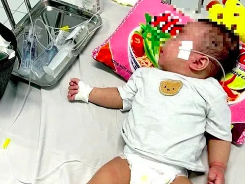 Thành phố Hồ Chí Minh chính thức công bố dịch sởi trên toàn thành phố