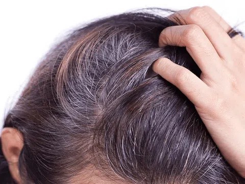 Tóc bạc sớm do đâu, khắc phục như thế nào?