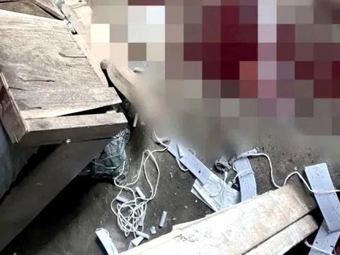 Tự chế pháo nổ, nam sinh lớp 10 bị nát cả bàn tay