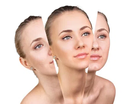 3 dấu hiệu nhận biết da bị lão hóa