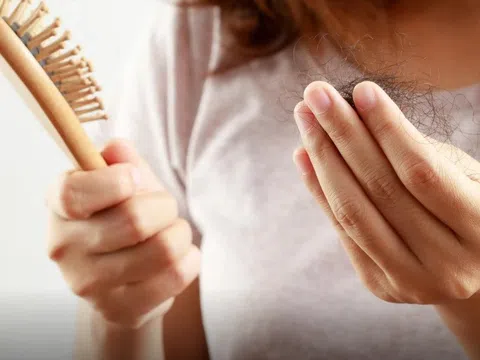 Bổ sung vitamin B có giúp giảm rụng tóc ở phụ nữ?