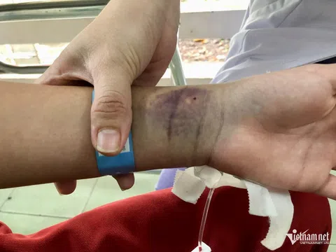 Thêm nhiều ca sốc nặng, dịch sốt xuất huyết chưa hạ nhiệt ở TPHCM