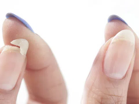 Cách chăm sóc móng tay mùa hanh khô