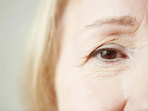 Thói quen khiến bạn nhanh già, lão hóa sớm