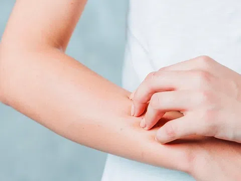 Dị ứng thời tiết có nguy hiểm không?