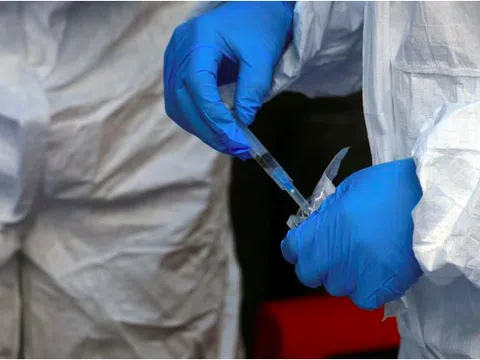 Dịch bệnh bí ẩn ở Congo, Bộ Y tế chủ động giám sát