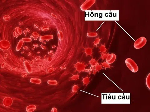Giảm tiểu cầu nguy hiểm thế nào?