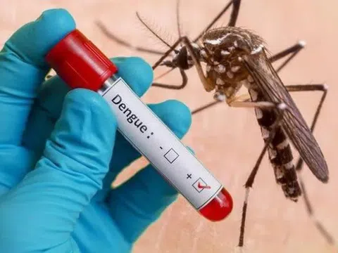 Sốt xuất huyết: Nguyên nhân, triệu chứng và cách phòng ngừa