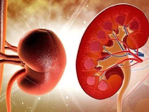 Ai có nguy cơ bị suy thận cấp?