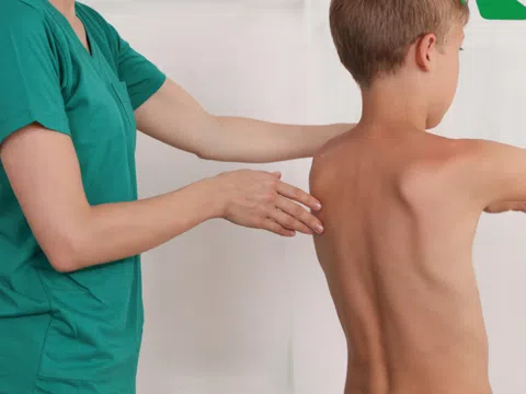 Nhận biết triệu chứng cong vẹo cột sống