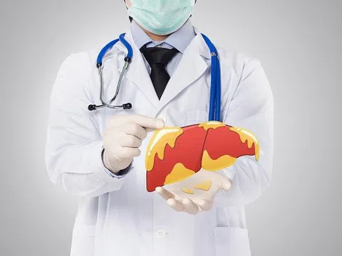 Những dấu hiệu cảnh báo gan nhiễm mỡ