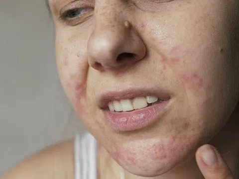 Tiềm ẩn nguy cơ sử dụng mỹ phẩm không đạt tiêu chuẩn chất lượng