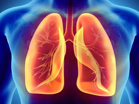 Dấu hiệu hay gặp nhất của tràn khí màng phổi