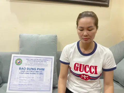 Lời cầu cứu của người phụ nữ bị bạo hành sau khi đã ly hôn