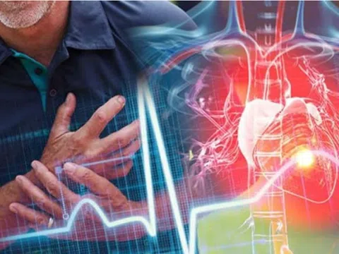 Biểu hiện của bệnh tim mạch giai đoạn sớm