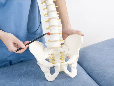 Triệu chứng của xẹp đốt sống do loãng xương