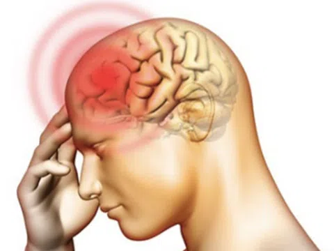 Viêm não có nguy cơ tử vong cao nếu kèm theo những điều này