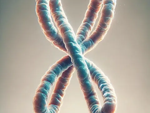 Hội chứng Fragile X: Nguyên nhân, triệu chứng, cách điều trị và phòng bệnh