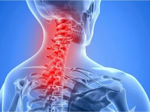 Đau cổ vai gáy có nguy hiểm, khi nào là bệnh lý phải nhập viện?