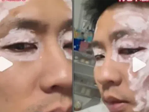 Mặt sưng vù sau khi lau bằng khăn giấy ở nhà hàng