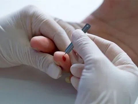 Tuyệt đối không nên làm điều này khi sơ cứu người đột quỵ!