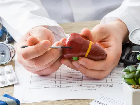 5 nguyên nhân phổ biến gây tăng men gan