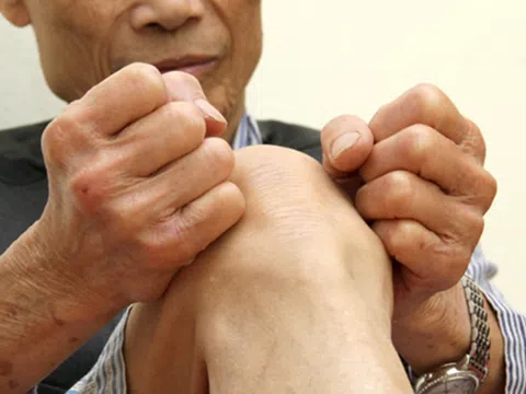 Thoái hóa khớp gối ở người cao tuổi: Cách chăm sóc và phòng ngừa hiệu quả