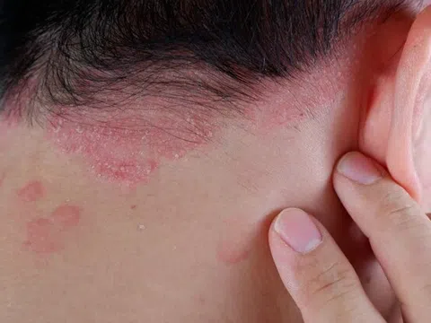 Nguy cơ biến chứng tiêu đường đến từ đâu