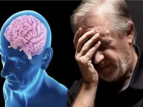 Nhận diện sớm bệnh Alzheimer và cách phòng ngừa hiệu quả