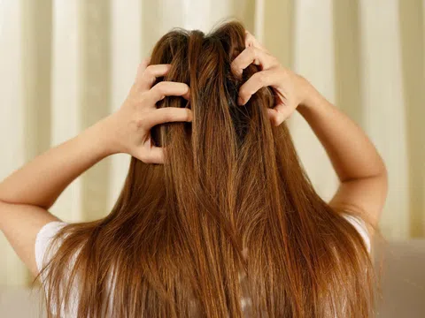 Bệnh viêm chân tóc - hãy đến Bảo Thanh Đường để điều trị dứt điểm