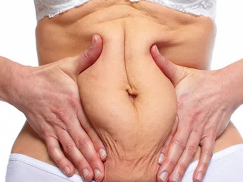 5 bài tập hiệu quả lấy lại cơ bụng dưới cho phụ nữ sau sinh