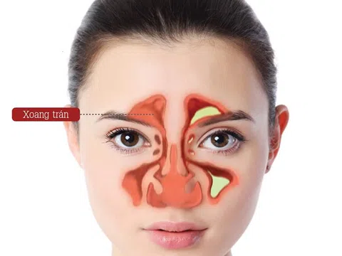 PGS.TS.BS Nguyễn Thượng Dong chia sẻ cách xử lý xoang hiệu quả từ thảo dược