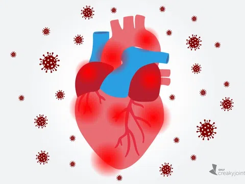 Di chứng tim mạch hậu COVID-19: Làm thế nào để chữa lành?