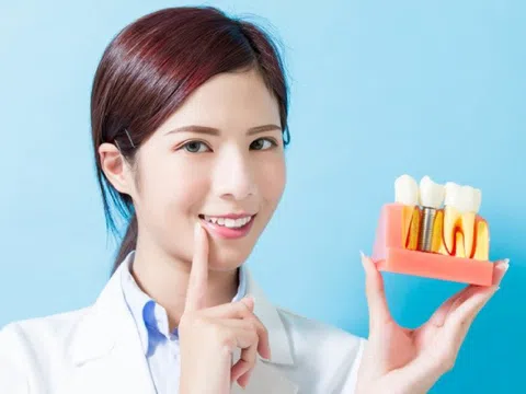 Những lý do nên cấy ghép implant để phục hồi răng mất