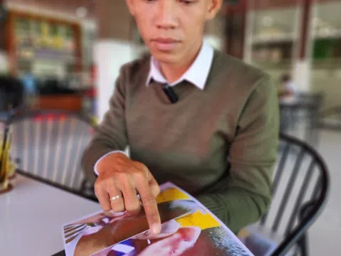 Kiên Giang: Khởi tố cô giáo đánh trẻ gây thương tích