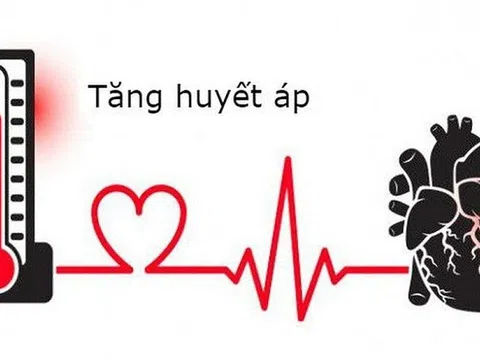 Tăng huyết áp là nguy cơ hàng đầu gây nên tai biến mạch máu não và đột quỵ