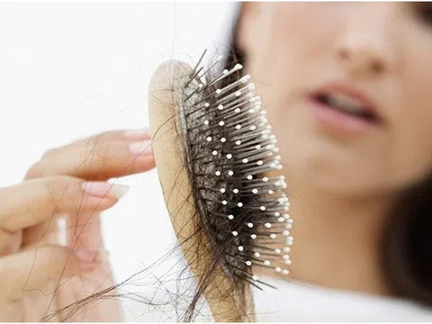 Rụng tóc sau sinh: Nguyên nhân và cách điều trị hiệu quả, nhanh chóng