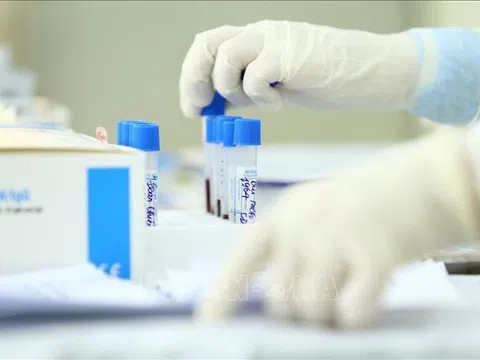 Trang thiết bị y tế, sinh phẩm xét nghiệm là mặt hàng phải kê khai giá