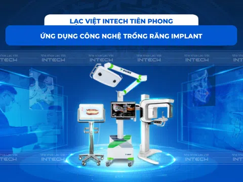 Bảng giá trồng răng Implant