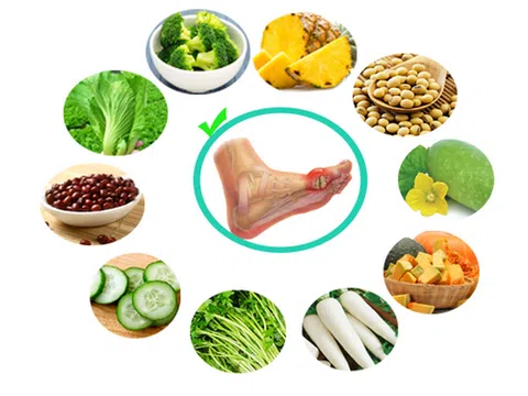 Những cách kiểm soát bệnh gút không cần thuốc