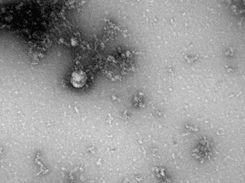 Hình ảnh đầu tiên về biến thể SARS-CoV-2 nguy hiểm ở Anh