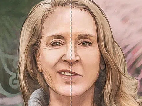 Bài kiểm tra nhanh chỉ với 4 bước để xác nhận người bị đột quỵ