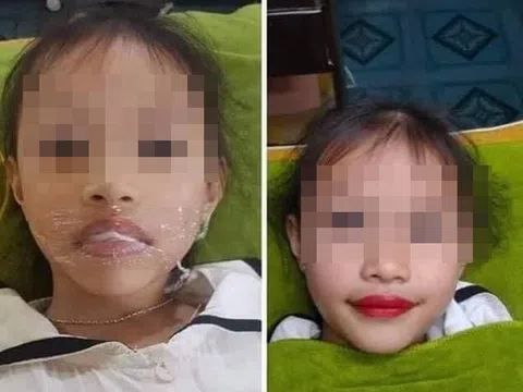 Bố xăm môi cho con gái 5 tuổi để quảng cáo khiến dư luận bức xúc